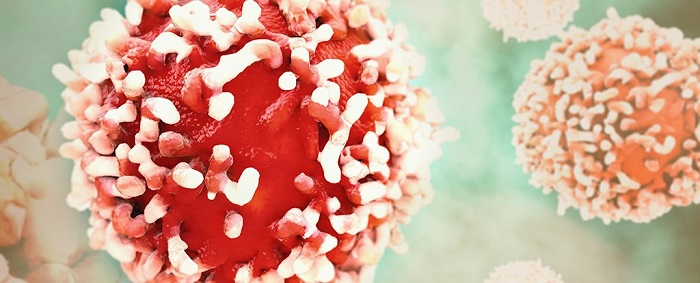 Test measures immune response to improve ovarian cancer diagnosis